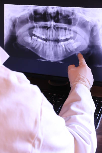 Best Emergency Root Canal Treatment in Vale, OR